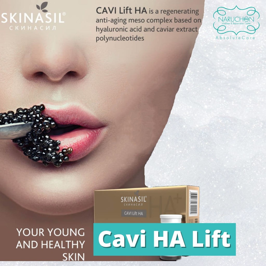 Cavi HA Lift