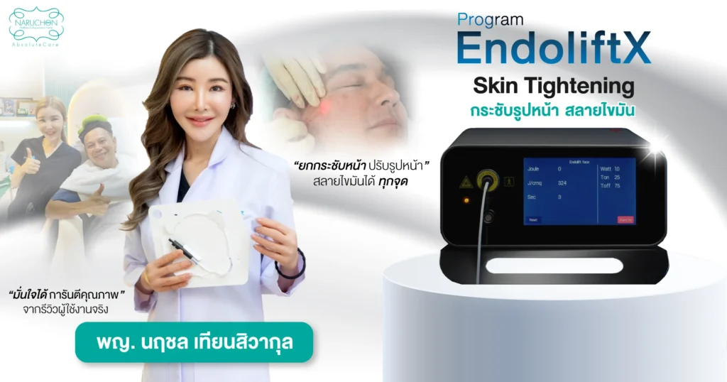 EndoliftX